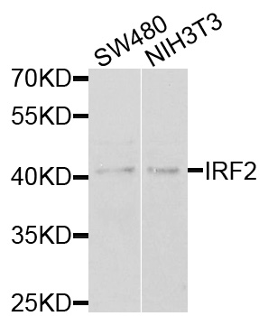IRF2 Antibody - Western blot analysis of extracts of various cells.