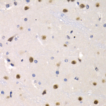IRF2 Antibody - Immunohistochemistry of paraffin-embedded rat brain tissue.