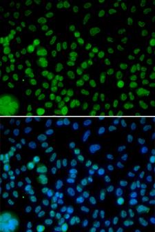 IRF2 Antibody - Immunofluorescence analysis of HeLa cells.