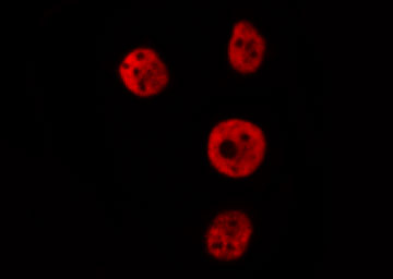 IRF2 Antibody - Staining HeLa cells by IF/ICC. The samples were fixed with PFA and permeabilized in 0.1% Triton X-100, then blocked in 10% serum for 45 min at 25°C. The primary antibody was diluted at 1:200 and incubated with the sample for 1 hour at 37°C. An Alexa Fluor 594 conjugated goat anti-rabbit IgG (H+L) antibody, diluted at 1/600, was used as secondary antibody.