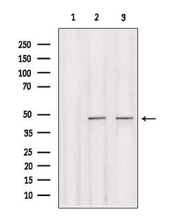 IRF2 Antibody - Western blot analysis of extracts of various samples using IRF2 antibody. Lane 1: rat brain treated with blocking peptide. Lane 2: rat brain; Lane 3: mouse brain;