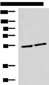 IRF2 Antibody - Western blot analysis of Raji and Jurkat cell lysates  using IRF2 Polyclonal Antibody at dilution of 1:1350
