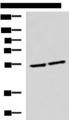 IRF2 Antibody - Western blot analysis of Raji and Jurkat cell lysates  using IRF2 Polyclonal Antibody at dilution of 1:1350