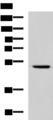 IRF2 Antibody - Western blot analysis of Hela cell lysate  using IRF2 Polyclonal Antibody at dilution of 1:900