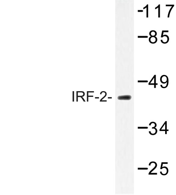 IRF2 Antibody - Western blot of IRF-2 (K129) pAb in extracts from Jurkat cells.