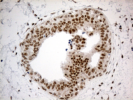 IRF2BP1 Antibody - Immunohistochemical staining of paraffin-embedded Human breast tissue within the normal limits using anti-IRF2BP1 mouse monoclonal antibody. (Heat-induced epitope retrieval by 1mM EDTA in 10mM Tris buffer. (pH8.5) at 120°C for 3 min. (1:500)
