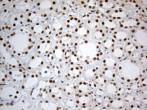 IRF2BP1 Antibody - Immunohistochemical staining of paraffin-embedded Human Kidney tissue within the normal limits using anti-IRF2BP1 mouse monoclonal antibody. (Heat-induced epitope retrieval by 1mM EDTA in 10mM Tris buffer. (pH8.5) at 120°C for 3 min. (1:500)