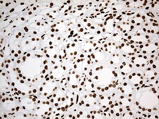 IRF2BP1 Antibody - Immunohistochemical staining of paraffin-embedded Human Kidney tissue within the normal limits using anti-IRF2BP1 mouse monoclonal antibody. (Heat-induced epitope retrieval by 1mM EDTA in 10mM Tris buffer. (pH8.5) at 120°C for 3 min. (1:500)