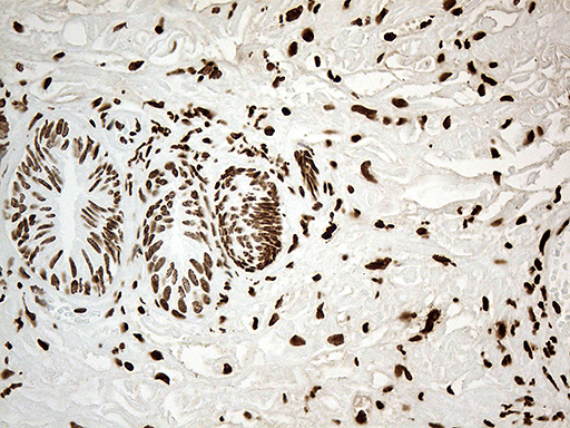 IRF2BP1 Antibody - Immunohistochemical staining of paraffin-embedded Human prostate tissue within the normal limits using anti-IRF2BP1 mouse monoclonal antibody. (Heat-induced epitope retrieval by 1mM EDTA in 10mM Tris buffer. (pH8.5) at 120°C for 3 min. (1:500)