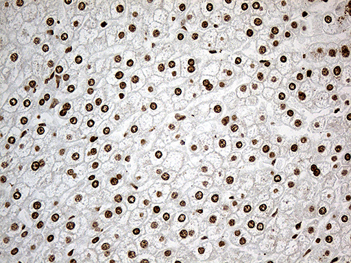 IRF2BP1 Antibody - Immunohistochemical staining of paraffin-embedded Human liver tissue within the normal limits using anti-IRF2BP1 mouse monoclonal antibody. (Heat-induced epitope retrieval by 1mM EDTA in 10mM Tris buffer. (pH8.5) at 120°C for 3 min. (1:500)