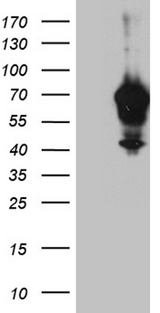 IRF2BP1 Antibody - HEK293T cells were transfected with the pCMV6-ENTRY control. (Left lane) or pCMV6-ENTRY IRF2BP1. (Right lane) cDNA for 48 hrs and lysed. Equivalent amounts of cell lysates. (5 ug per lane) were separated by SDS-PAGE and immunoblotted with anti-IRF2BP1. (1:2000)