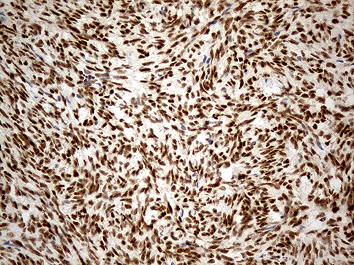 IRF2BP1 Antibody - Immunohistochemical staining of paraffin-embedded Human Ovary tissue within the normal limits using anti-IRF2BP1 mouse monoclonal antibody. (Heat-induced epitope retrieval by 1mM EDTA in 10mM Tris buffer. (pH8.5) at 120°C for 3 min. (1:1000)