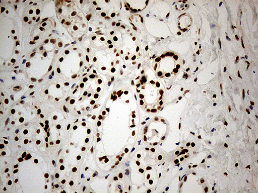 IRF2BP1 Antibody - Immunohistochemical staining of paraffin-embedded Human Kidney tissue within the normal limits using anti-IRF2BP1 mouse monoclonal antibody. (Heat-induced epitope retrieval by 1mM EDTA in 10mM Tris buffer. (pH8.5) at 120°C for 3 min. (1:1000)