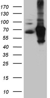 IRF2BP1 Antibody - HEK293T cells were transfected with the pCMV6-ENTRY control. (Left lane) or pCMV6-ENTRY IRF2BP1. (Right lane) cDNA for 48 hrs and lysed