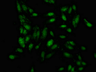 IRF2BP1 Antibody - Immunofluorescence staining of Hela cells at a dilution of 1:133, counter-stained with DAPI. The cells were fixed in 4% formaldehyde, permeabilized using 0.2% Triton X-100 and blocked in 10% normal Goat Serum. The cells were then incubated with the antibody overnight at 4 °C.The secondary antibody was Alexa Fluor 488-congugated AffiniPure Goat Anti-Rabbit IgG (H+L) .