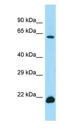 IRF2BP2 Antibody - IRF2BP2 antibody Western Blot of 721_B.  This image was taken for the unconjugated form of this product. Other forms have not been tested.