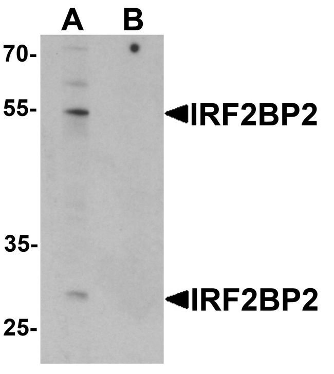 IRF2BP2 Antibody - Western blot analysis of IRF2BP2 in HeLa cell lysate with IRF2BP2 antibody at 1 ug/ml in (A) the absence and (B) the presence of blocking peptide