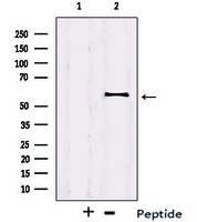 IRF2BP2 Antibody - Western blot analysis on Jurkat cell lysates using IRF2BP2 antibody