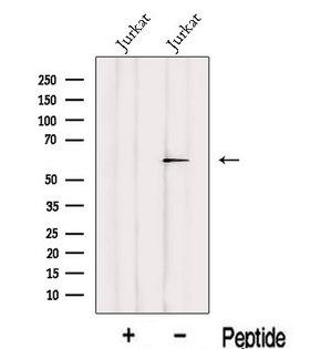 IRF2BP2 Antibody - Western blot analysis of extracts of Jurkat cells using IRF2BP2 antibody. The lane on the left was treated with blocking peptide.