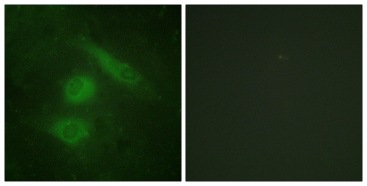 IRF3 Antibody - Immunofluorescence analysis of HeLa cells, using IRF3 Antibody. The picture on the right is blocked with the synthesized peptide.