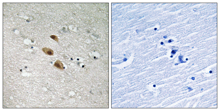 IRF3 Antibody - Immunohistochemistry analysis of paraffin-embedded human brain tissue, using IRF-3 Antibody. The picture on the right is blocked with the synthesized peptide.