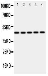 IRF3 Antibody - Anti-IRF3 antibody, Western blotting All lanes: Anti IRF3 at 0.5ug/ml Lane 1: A549 Whole Cell Lysate at 40ug Lane 2: HELA Whole Cell Lysate at 40ug Lane 3: JURKAT Whole Cell Lysate at 40ug Lane 4: 293T Whole Cell Lysate at 40ug Lane 5: MCF-7 Whole Cell Lysate at 40ug Predicted bind size: 47KD Observed bind size: 47KD