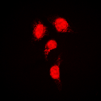 IRF3 Antibody - Immunofluorescent analysis of IRF3 staining in HeLa cells. Formalin-fixed cells were permeabilized with 0.1% Triton X-100 in TBS for 5-10 minutes and blocked with 3% BSA-PBS for 30 minutes at room temperature. Cells were probed with the primary antibody in 3% BSA-PBS and incubated overnight at 4 deg C in a humidified chamber. Cells were washed with PBST and incubated with a DyLight 594-conjugated secondary antibody (red) in PBS at room temperature in the dark. DAPI was used to stain the cell nuclei (blue).