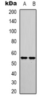 IRF3 Antibody - Western blot analysis of IRF3 (pS385) expression in HEK293T (A); HT29 (B) whole cell lysates.