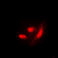 IRF3 Antibody - Immunofluorescent analysis of IRF3 (pS385) staining in HeLa cells. Formalin-fixed cells were permeabilized with 0.1% Triton X-100 in TBS for 5-10 minutes and blocked with 3% BSA-PBS for 30 minutes at room temperature. Cells were probed with the primary antibody in 3% BSA-PBS and incubated overnight at 4 deg C in a humidified chamber. Cells were washed with PBST and incubated with a DyLight 594-conjugated secondary antibody (red) in PBS at room temperature in the dark. DAPI was used to stain the cell nuclei (blue).