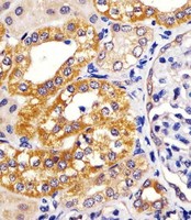 IRF3 Antibody - Antibody staining IRF3 in human kidney sections by Immunohistochemistry (IHC-P - paraformaldehyde-fixed, paraffin-embedded sections). Tissue was fixed with formaldehyde and blocked with 3% BSA for 0. 5 hour at room temperature; antigen retrieval was by heat mediation with a citrate buffer (pH 6). Samples were incubated with primary antibody (1:25) for 1 hours at 37°C. A undiluted biotinylated goat polyvalent antibody was used as the secondary antibody.