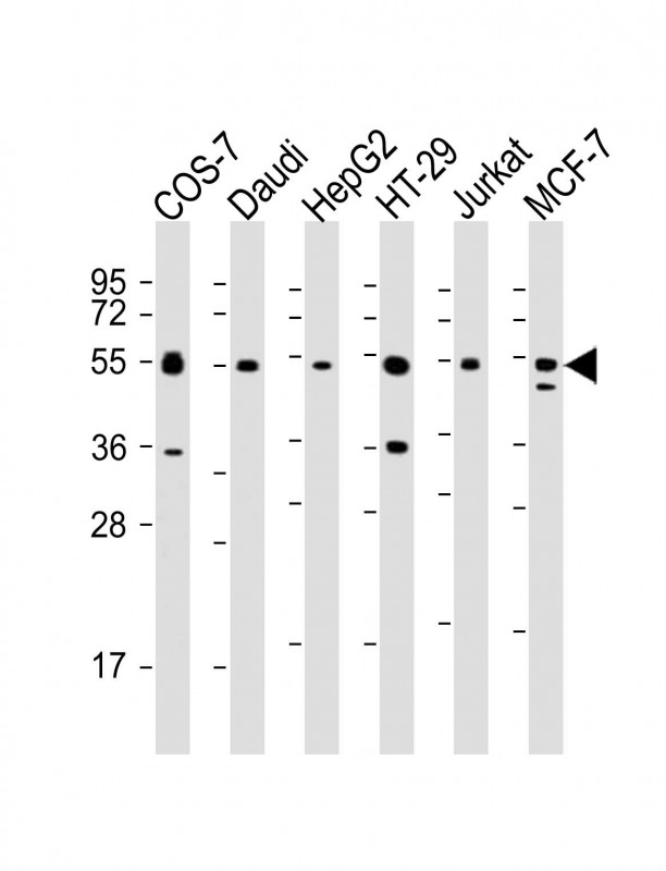 IRF3 Antibody - All lanes: Anti-IRF3 Antibody at 1:2000 dilution. Lane 1: COS-7 whole cell lysate. Lane 2: Daudi whole cell lysate. Lane 3: HepG2 whole cell lysate. Lane 4: HT-29 whole cell lysate. Lane 5: Jurkat whole cell lysate. Lane 6: MCF-7 whole cell lysate Lysates/proteins at 20 ug per lane. Secondary Goat Anti-mouse IgG, (H+L), Peroxidase conjugated at 1:10000 dilution. Predicted band size: 47 kDa. Blocking/Dilution buffer: 5% NFDM/TBST.