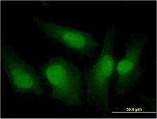 IRF3 Antibody - Immunofluorescence of monoclonal antibody to IRF3 on HeLa cell . [antibody concentration 10 ug/ml]