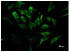 IRF3 Antibody - Immunofluorescent staining using IRF3 antibody. Immunostaining analysis in HeLa cells. HeLa cells were fixed with 4% paraformaldehyde and permeabilized with 0.1% Triton X-100 in PBS. The cells were stained with anti-IRF3 antibody.