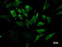 IRF3 Antibody - Immunostaining analysis in HeLa cells. HeLa cells were fixed with 4% paraformaldehyde and permeabilized with 0.1% Triton X-100 in PBS. The cells were immunostained with anti-IRF3 mAb.