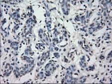 IRF3 Antibody - IHC of paraffin-embedded breast tissue using anti-IRF3 mouse monoclonal antibody. (Dilution 1:50).