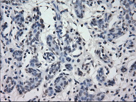 IRF3 Antibody - IHC of paraffin-embedded breast tissue using anti-IRF3 mouse monoclonal antibody. (Dilution 1:50).