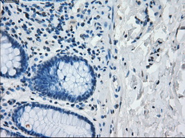 IRF3 Antibody - IHC of paraffin-embedded colon tissue using anti-IRF3 mouse monoclonal antibody. (Dilution 1:50).