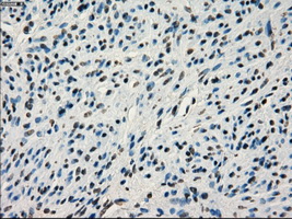 IRF3 Antibody - IHC of paraffin-embedded endometrium tissue using anti-IRF3 mouse monoclonal antibody. (Dilution 1:50).