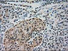 IRF3 Antibody - Immunohistochemical staining of paraffin-embedded pancreas tissue using anti-IRF3 mouse monoclonal antibody. (Dilution 1:50).