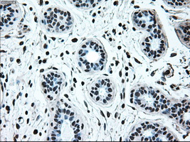 IRF3 Antibody - Immunohistochemical staining of paraffin-embedded breast tissue using anti-IRF3 mouse monoclonal antibody. (Dilution 1:50).