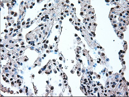 IRF3 Antibody - Immunohistochemical staining of paraffin-embedded lung tissue using anti-IRF3 mouse monoclonal antibody. (Dilution 1:50).