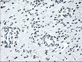 IRF3 Antibody - Immunohistochemical staining of paraffin-embedded Ovary tissue using anti-IRF3 mouse monoclonal antibody. (Dilution 1:50).