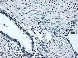 IRF3 Antibody - Immunohistochemical staining of paraffin-embedded endometrium tissue using anti-IRF3 mouse monoclonal antibody. (Dilution 1:50).