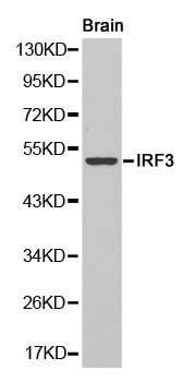 IRF3 Antibody - Western blot analysis of extracts of human brain cell line, using IRF3 antibody.