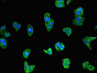 IRF3 Antibody - Immunofluorescent analysis of HepG2 cells using IRF3 Antibody at dilution of 1:100 and Alexa Fluor 488-congugated AffiniPure Goat Anti-Rabbit IgG(H+L)