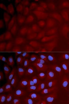 IRF3 Antibody - Immunofluorescence analysis of U2OS cells using IRF3 antibody.