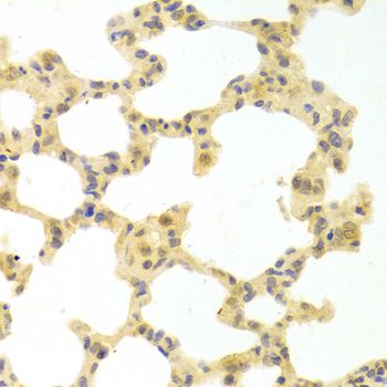 IRF3 Antibody - Immunohistochemistry of paraffin-embedded rat lung using IRF3 antibody at dilution of 1:100 (40x lens).