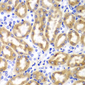 IRF3 Antibody - Immunohistochemistry of paraffin-embedded mouse kidney using IRF3 antibody at dilution of 1:100 (40x lens).