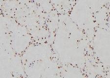 IRF3 Antibody - 1:100 staining human lung tissue by IHC-P. The sample was formaldehyde fixed and a heat mediated antigen retrieval step in citrate buffer was performed. The sample was then blocked and incubated with the antibody for 1.5 hours at 22°C. An HRP conjugated goat anti-rabbit antibody was used as the secondary.