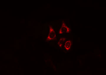 IRF3 Antibody - Staining HT29 cells by IF/ICC. The samples were fixed with PFA and permeabilized in 0.1% Triton X-100, then blocked in 10% serum for 45 min at 25°C. The primary antibody was diluted at 1:200 and incubated with the sample for 1 hour at 37°C. An Alexa Fluor 594 conjugated goat anti-rabbit IgG (H+L) Ab, diluted at 1/600, was used as the secondary antibody.